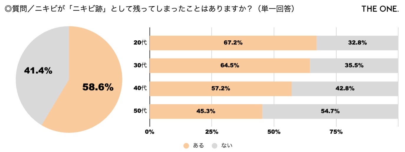 【20〜50代女性555名に聞く！ニキビ・ニキビ跡悩み調査】7割以上（72.4%）が悩み経験アリ！／マスク解禁の一方で「他人の視線が気になり、外すのを躊躇」と約7割が回答のサブ画像3